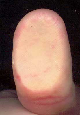 Odcisk palca